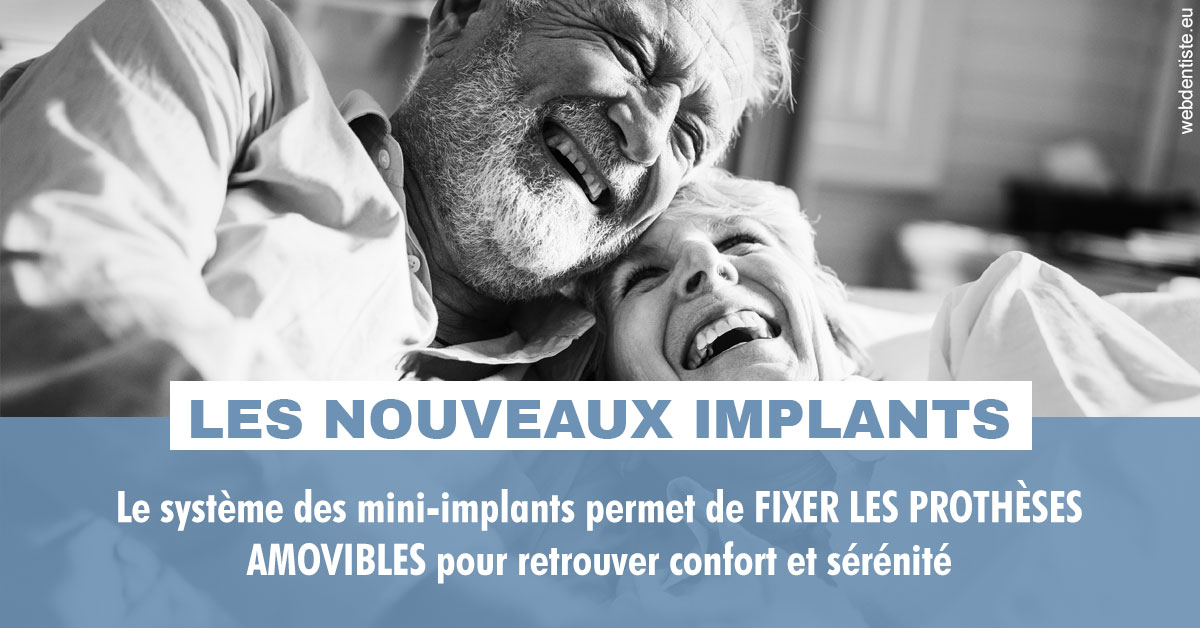 https://dr-poirier-yves.chirurgiens-dentistes.fr/Les nouveaux implants 2
