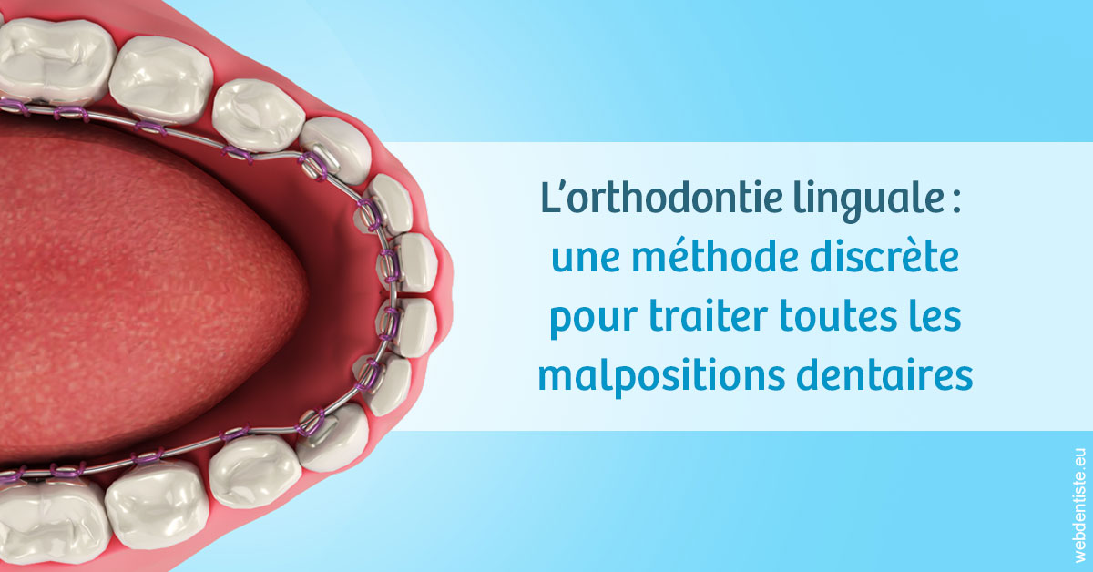 https://dr-poirier-yves.chirurgiens-dentistes.fr/L'orthodontie linguale 1
