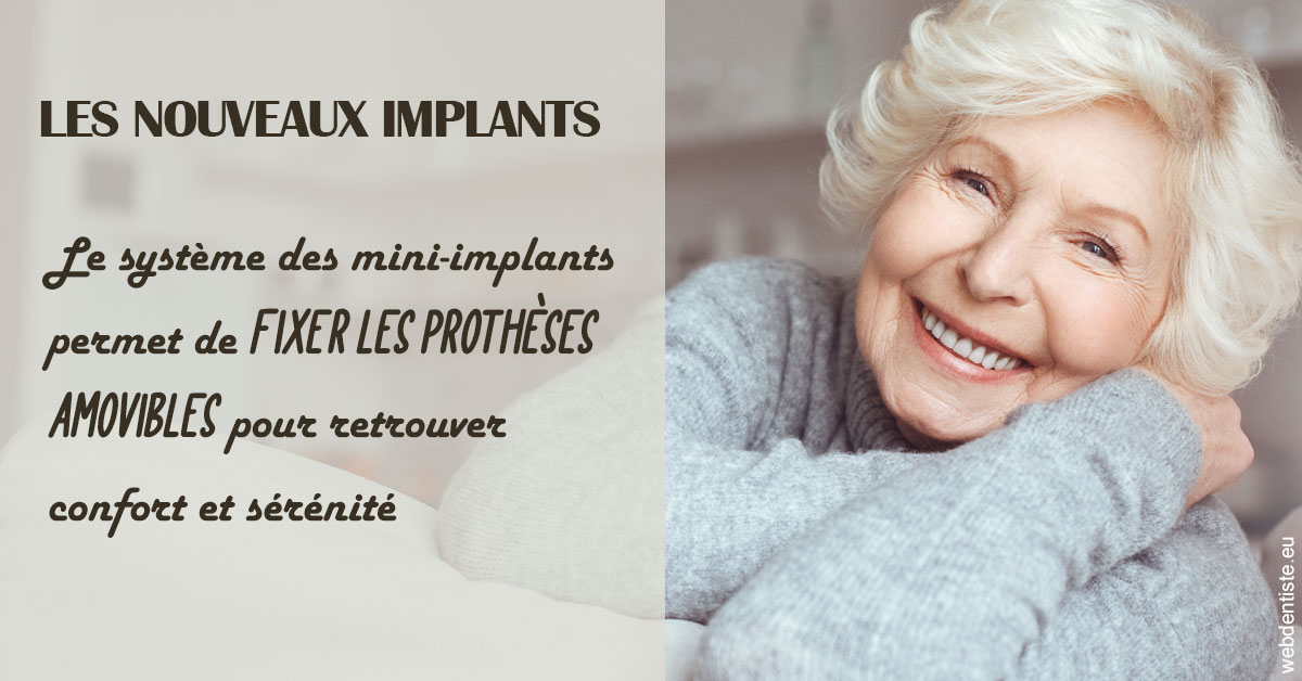https://dr-poirier-yves.chirurgiens-dentistes.fr/Les nouveaux implants 1