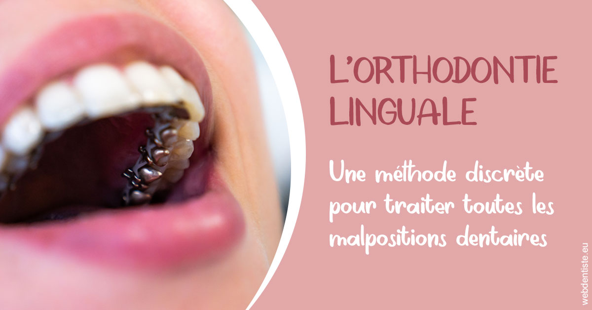https://dr-poirier-yves.chirurgiens-dentistes.fr/L'orthodontie linguale 2