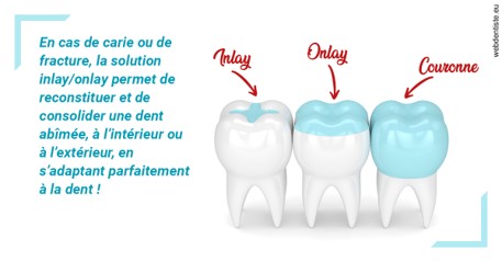 https://dr-poirier-yves.chirurgiens-dentistes.fr/L'INLAY ou l'ONLAY