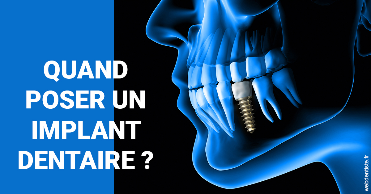 https://dr-poirier-yves.chirurgiens-dentistes.fr/Les implants 1