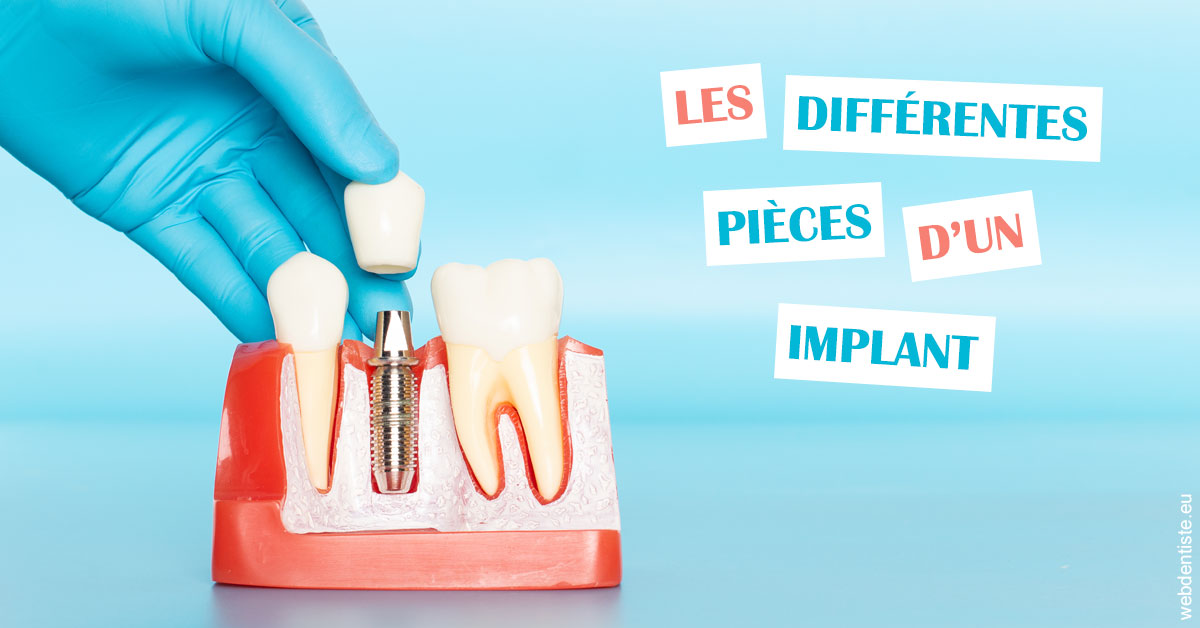 https://dr-poirier-yves.chirurgiens-dentistes.fr/Les différentes pièces d’un implant 2