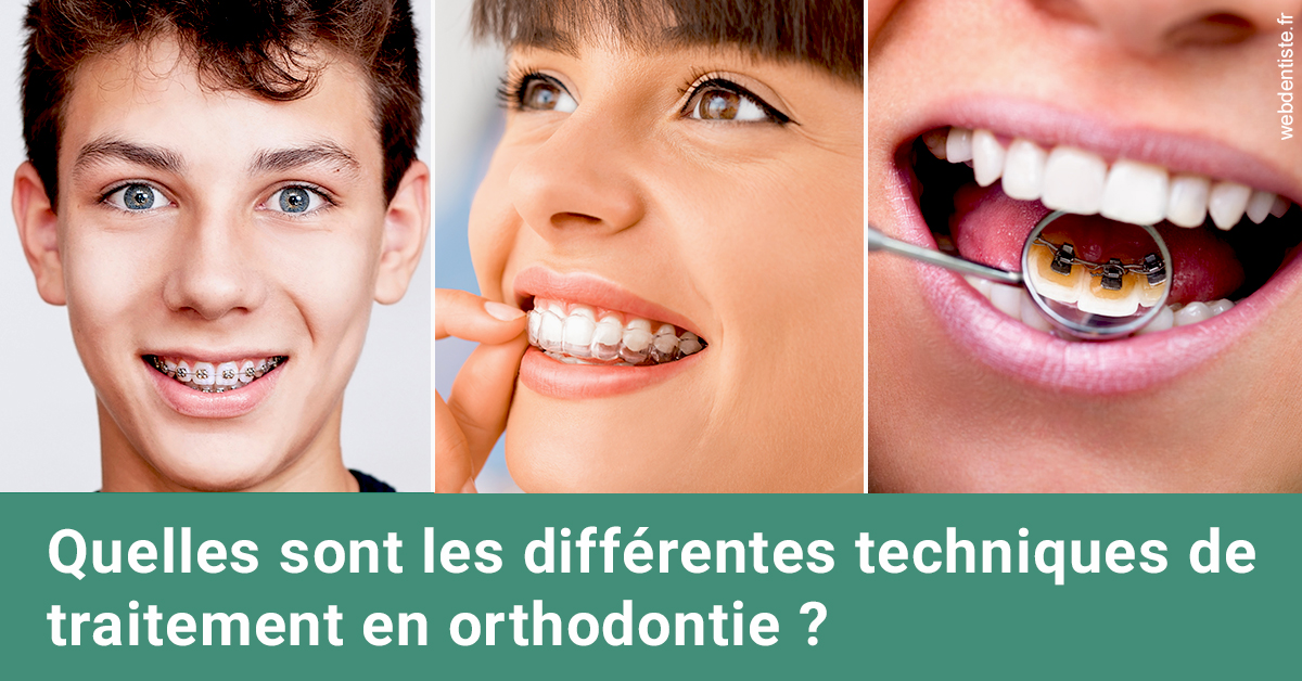 https://dr-poirier-yves.chirurgiens-dentistes.fr/Les différentes techniques de traitement 2