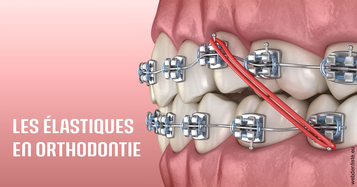 https://dr-poirier-yves.chirurgiens-dentistes.fr/Elastiques orthodontie 2